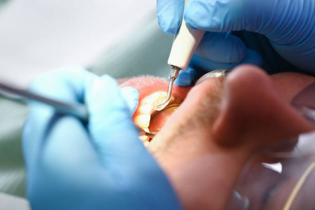 Best Broken or Chipped Tooth Repair in Carolina Forest, SC